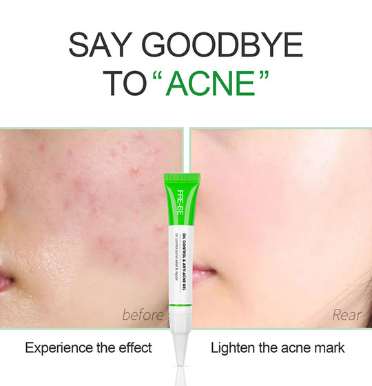 Anti Acne Gel Cinere