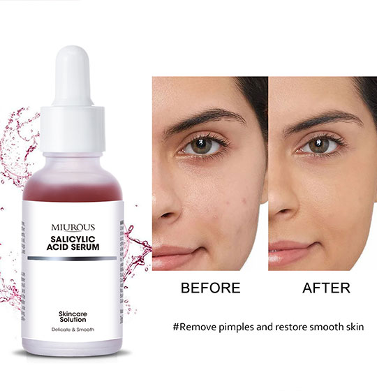 AHA BHA Peeling Skin Care Facial Serum